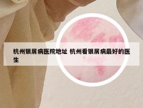 杭州银屑病医院地址 杭州看银屑病最好的医生