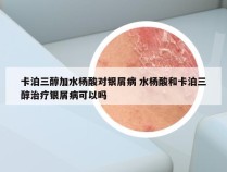 卡泊三醇加水杨酸对银屑病 水杨酸和卡泊三醇治疗银屑病可以吗
