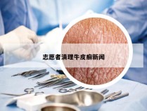 志愿者清理牛皮癣新闻