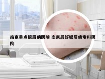 南京重点银屑病医院 南京最好银屑病专科医院