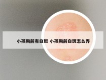 小孩胸前有白斑 小孩胸前白斑怎么弄