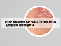 到北京看银屑病哪家医院比较好的医院比较好 北京看银屑病哪里医院好