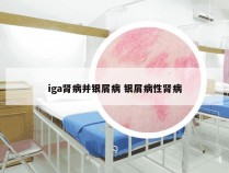 iga肾病并银屑病 银屑病性肾病