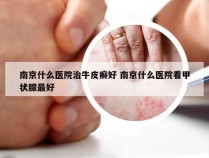 南京什么医院治牛皮癣好 南京什么医院看甲状腺最好