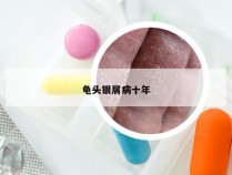 龟头银屑病十年