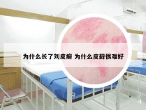 为什么长了刘皮癣 为什么皮藓很难好