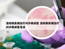 洛阳银屑病治疗问诊杨淑莲 洛阳银屑病治疗问诊杨淑莲电话