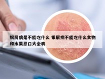 银屑病是不能吃什么 银屑病不能吃什么食物和水果忌口大全表