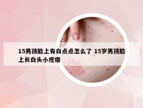 15男孩脸上有白点点怎么了 15岁男孩脸上长白头小疙瘩