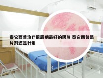 泰它西普治疗银屑病最好的医院 泰它西普是片剂还是针剂