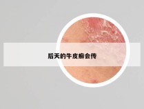 后天的牛皮癣会传