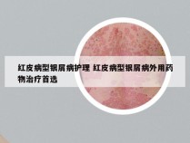 红皮病型银屑病护理 红皮病型银屑病外用药物治疗首选
