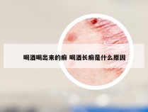 喝酒喝出来的癣 喝酒长癣是什么原因