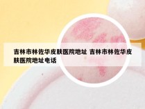 吉林市林佐华皮肤医院地址 吉林市林佐华皮肤医院地址电话