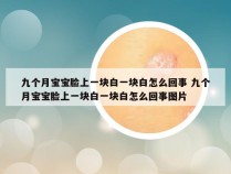 九个月宝宝脸上一块白一块白怎么回事 九个月宝宝脸上一块白一块白怎么回事图片
