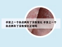 手背上一个白点两年了没有变化 手背上一个白点两年了没有变化正常吗
