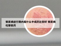 银屑病进行期内服什么中成药比较好 银屑病吃那些药