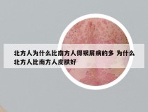 北方人为什么比南方人得银屑病的多 为什么北方人比南方人皮肤好