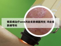 银屑病治疗wen鸿业皮肤病医院优 鸿业皮肤病专科