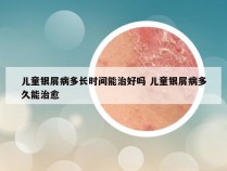 儿童银屑病多长时间能治好吗 儿童银屑病多久能治愈