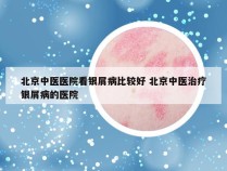 北京中医医院看银屑病比较好 北京中医治疗银屑病的医院