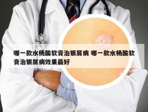 哪一款水杨酸软膏治银屑病 哪一款水杨酸软膏治银屑病效果最好