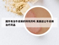国外有治牛皮癣的特效药吗 美国进口牛皮癣治疗药品
