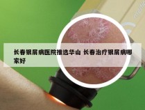 长春银屑病医院推选华山 长春治疗银屑病哪家好