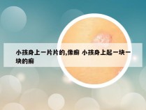 小孩身上一片片的,像癣 小孩身上起一块一块的癣