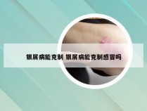 银屑病能克制 银屑病能克制感冒吗
