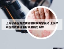 上海华山医院皮肤科银屑病专家预约 上海华山医院皮肤科治疗银屑病怎么样