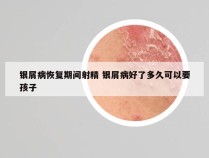 银屑病恢复期间射精 银屑病好了多久可以要孩子