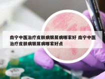 南宁中医治疗皮肤病银屑病哪家好 南宁中医治疗皮肤病银屑病哪家好点