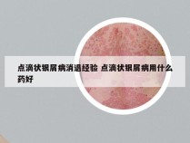 点滴状银屑病消退经验 点滴状银屑病用什么药好