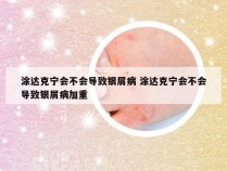 涂达克宁会不会导致银屑病 涂达克宁会不会导致银屑病加重
