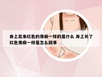 身上出来红色的像癣一样的是什么 身上长了红色像癣一样是怎么回事
