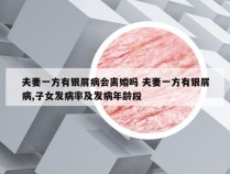 夫妻一方有银屑病会离婚吗 夫妻一方有银屑病,子女发病率及发病年龄段