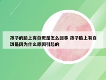 孩子的脸上有白斑是怎么回事 孩子脸上有白斑是因为什么原因引起的