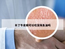 长了牛皮癣可以吃深海鱼油吗