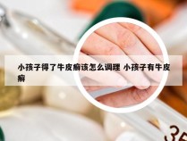 小孩子得了牛皮癣该怎么调理 小孩子有牛皮癣