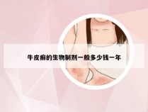 牛皮癣的生物制剂一般多少钱一年