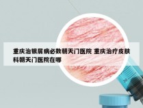 重庆治银屑病必数朝天门医院 重庆治疗皮肤科朝天门医院在哪