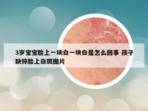 3岁宝宝脸上一块白一块白是怎么回事 孩子缺锌脸上白斑图片