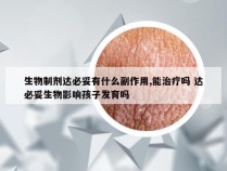 生物制剂达必妥有什么副作用,能治疗吗 达必妥生物影响孩子发育吗