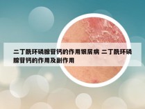 二丁酰环磷腺苷钙的作用银屑病 二丁酰环磷腺苷钙的作用及副作用