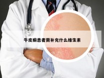 牛皮癣患者需补充什么维生素