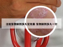 注射生物制剂多久见效果 生物制剂多久一针