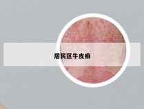 居民区牛皮癣