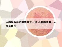 小孩嘴角旁边突然白了一块 小孩嘴角有一小块是白色