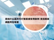贵阳什么医院可打银屑病生物制剂 贵阳银屑病医院在哪里